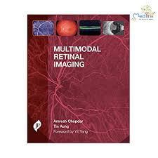 Multimodal Retinal Imaging