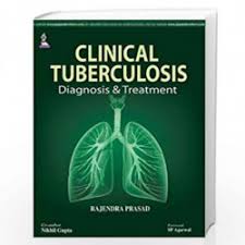 Clinical Tuberculosis Diagnosis & Treatment