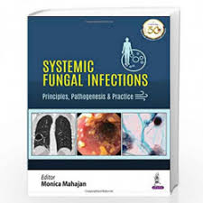 Systemic Fungal Infections: Principles, Pathogenesis & Practice